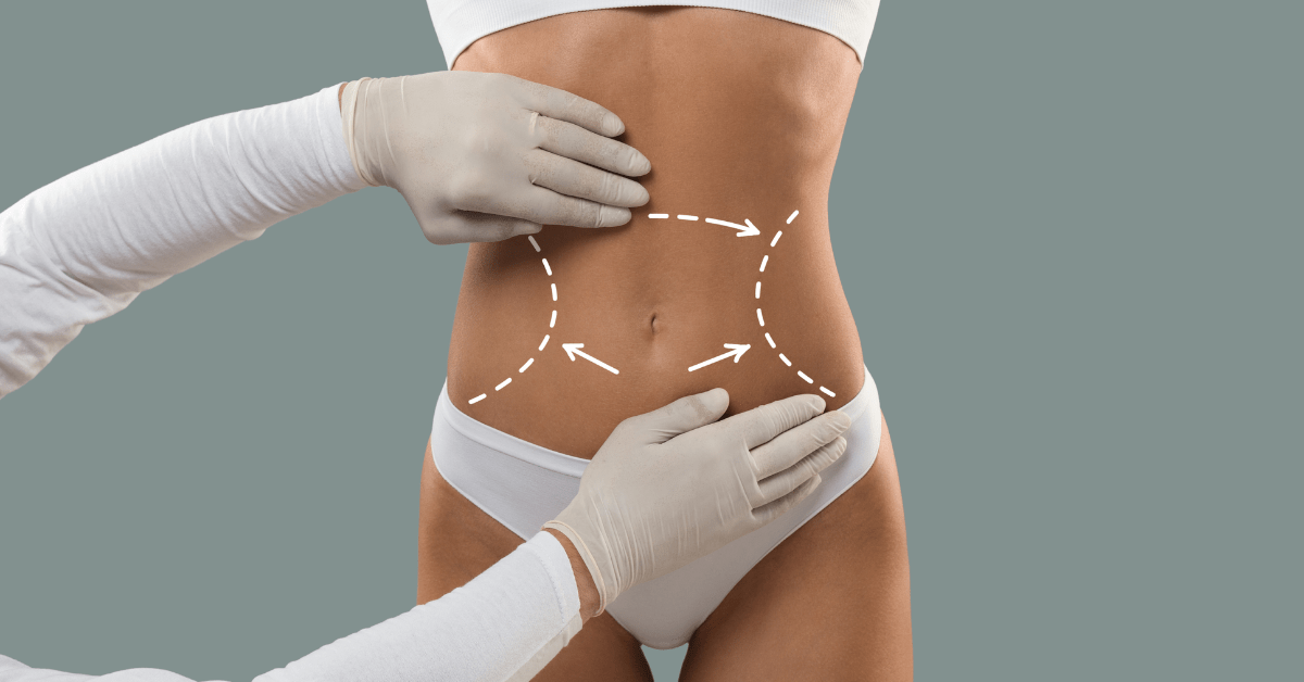 What is Non-Surgical Body Contouring?